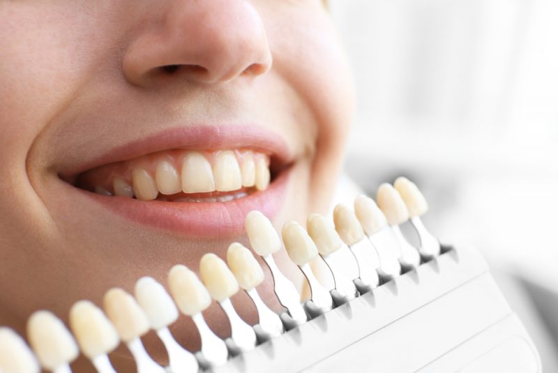 5 мифов о здоровье зубов и кариесе, в которые пора перестать верить. Изображение номер 4