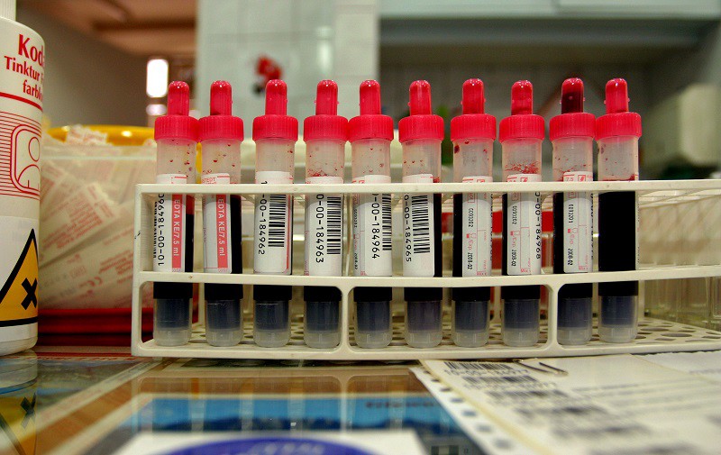 Биохимический анализ крови как часто нужно делать thumbnail