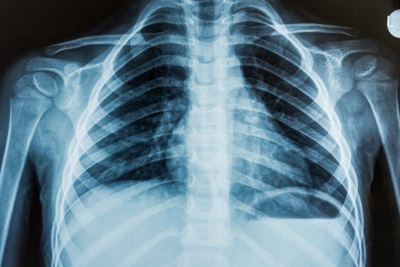 Правда ли, что МРТ и рентген опасны для здоровья. Изображение номер 7