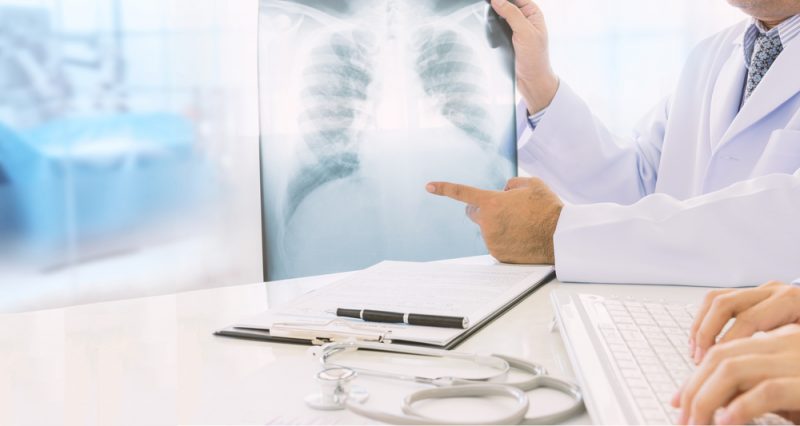 Признаки воспаления лёгких: что делать при пневмонии и когда идти к врачу. Изображение номер 2