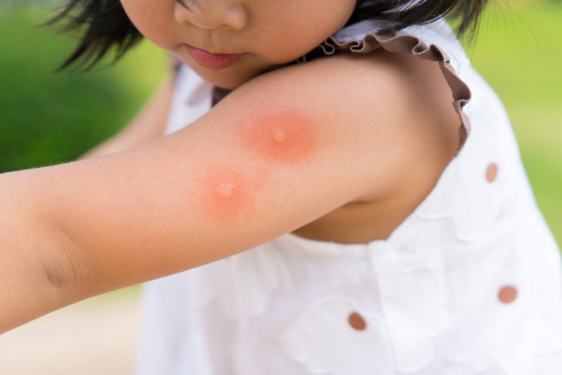 6 самых эффективных способов защиты от комаров и прочих насекомых. Изображение номер 5