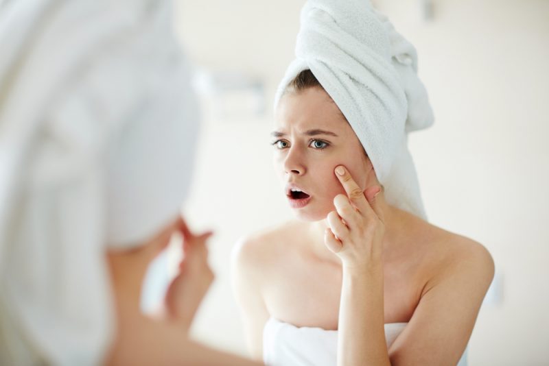 Что такое экспозом-факторы и как они влияют на вашу кожу. Изображение номер 4