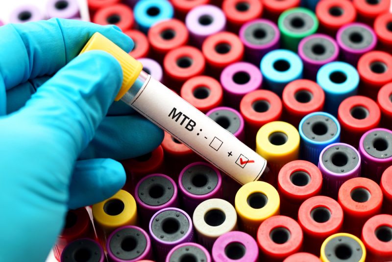 Почему туберкулёз остаётся серьёзной проблемой и как лечат это заболевание в 2020 году. Изображение номер 1