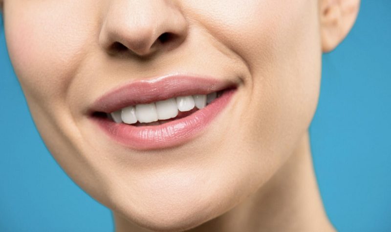 Некрасивая улыбка: 10 вопросов стоматологу о том, как исправить прикус. Изображение номер 2