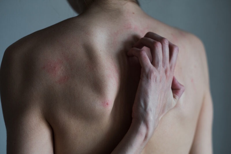 Межрёберная невралгия: симптомы, причины и методы лечения. Изображение номер 2